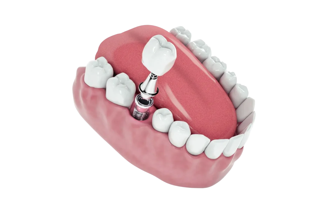 bf775ced9d4a13f9f3180e4a3c327915d79a19de